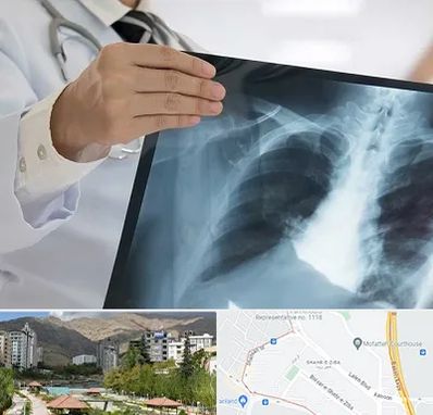 فوق تخصص ریه در شهر زیبا 