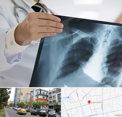 فوق تخصص ریه در هفده شهریور تبریز