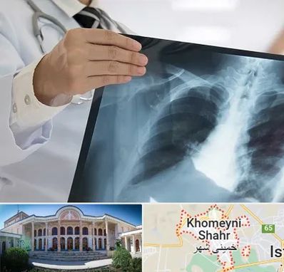 فوق تخصص ریه در خمینی شهر