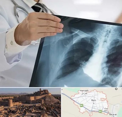 فوق تخصص ریه در بم
