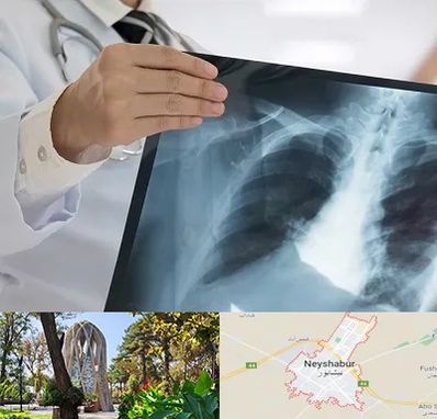 فوق تخصص ریه در نیشابور