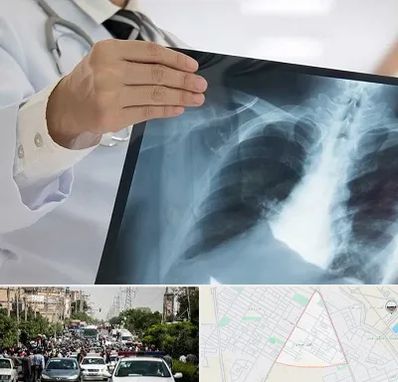 فوق تخصص ریه در سیدی مشهد