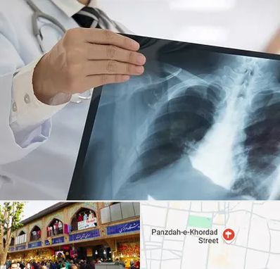 فوق تخصص ریه در 15 خرداد
