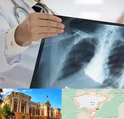 فوق تخصص ریه در خوی