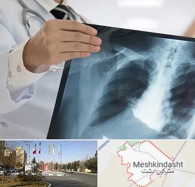 فوق تخصص ریه در مشکین دشت