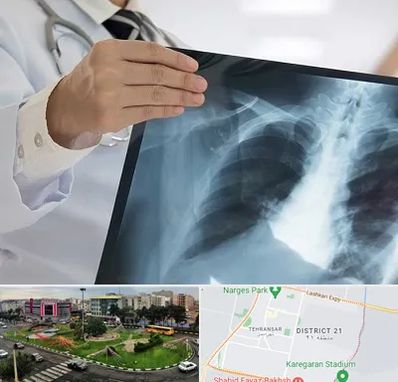 فوق تخصص ریه در تهرانسر 