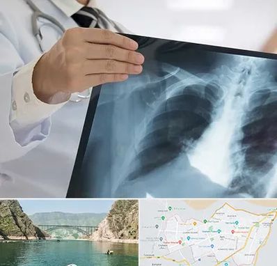 فوق تخصص ریه در ایلام