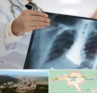 فوق تخصص ریه در گرگان
