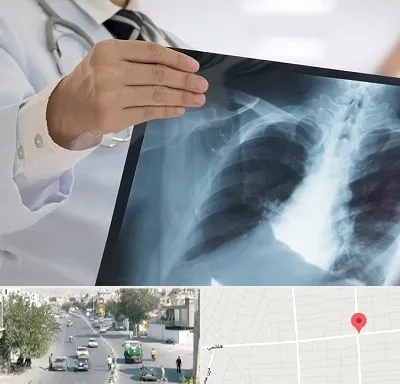 فوق تخصص ریه در هاشمی