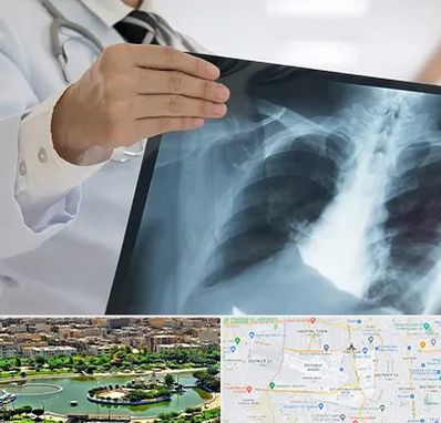 فوق تخصص ریه در منطقه 9 تهران 