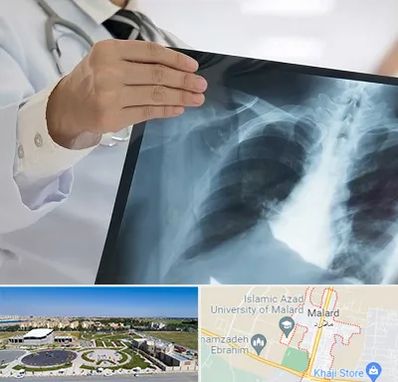 فوق تخصص ریه در ملارد