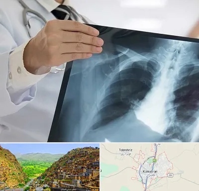 فوق تخصص ریه در کامیاران