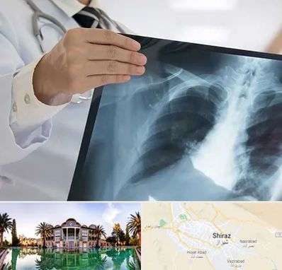 فوق تخصص ریه در شیراز
