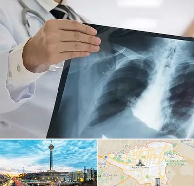 فوق تخصص ریه در تهران