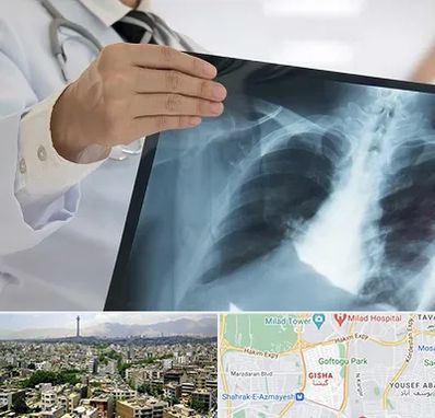 فوق تخصص ریه در گیشا 