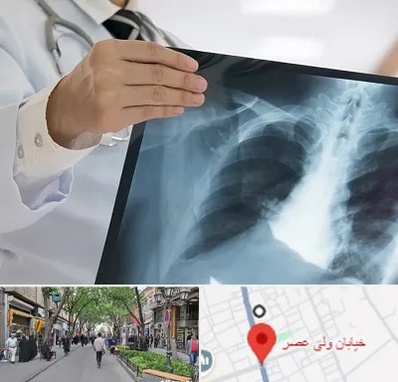 فوق تخصص ریه در ولیعصر شهریار