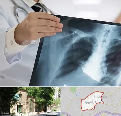 فوق تخصص ریه در دزاشیب