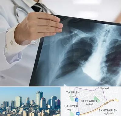 فوق تخصص ریه در قیطریه 