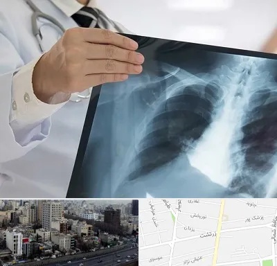 فوق تخصص ریه در زرتشت