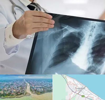 فوق تخصص ریه در تنکابن