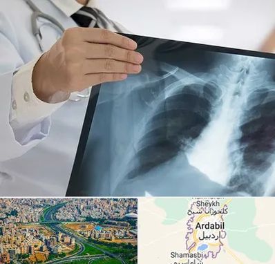 فوق تخصص ریه در اردبیل