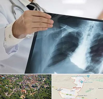 فوق تخصص ریه در دماوند