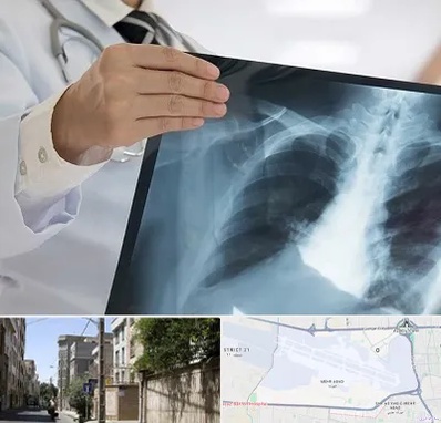 فوق تخصص ریه در مهرآباد