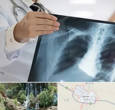 فوق تخصص ریه در شیروان