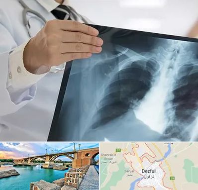 فوق تخصص ریه در دزفول