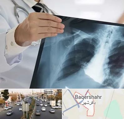 فوق تخصص ریه در باقرشهر