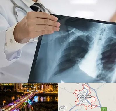 فوق تخصص ریه در سقز