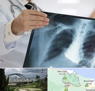 فوق تخصص ریه در چالوس