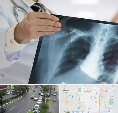 فوق تخصص ریه در ستارخان 