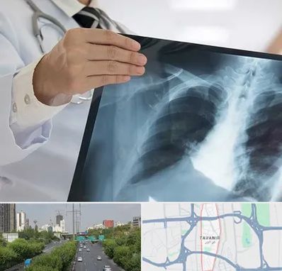 فوق تخصص ریه در توانیر