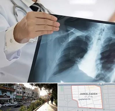 فوق تخصص ریه در خیابان جمالزاده