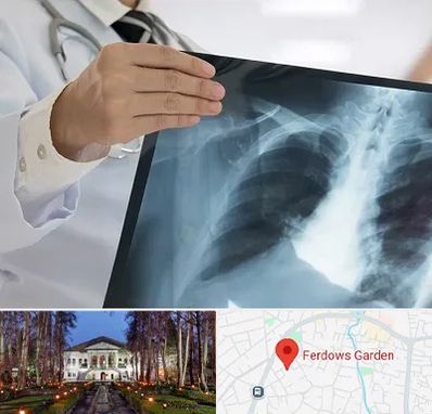 فوق تخصص ریه در باغ فردوس