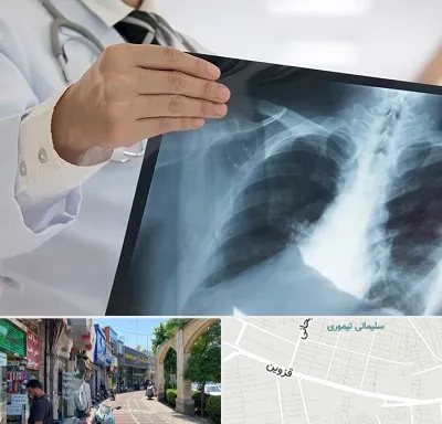 فوق تخصص ریه در خیابان قزوین