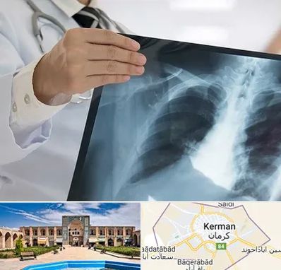 فوق تخصص ریه در کرمان