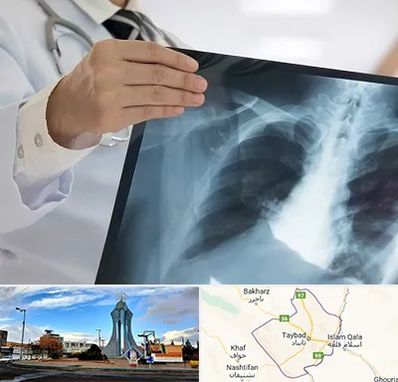 فوق تخصص ریه در تایباد