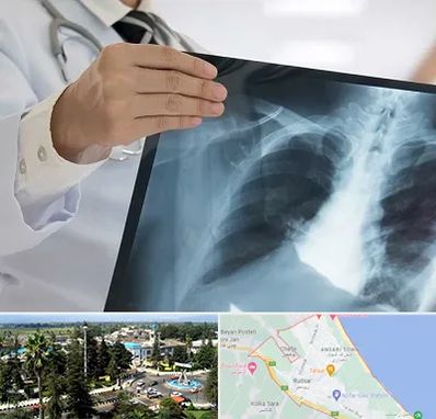 فوق تخصص ریه در رودسر