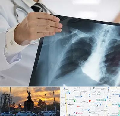 فوق تخصص ریه در میدان حر 