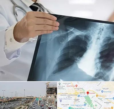 فوق تخصص ریه در بلوار توس مشهد