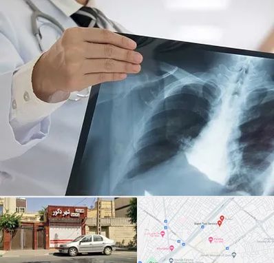 فوق تخصص ریه در باجک قم