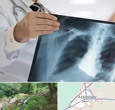 فوق تخصص ریه در آزادشهر