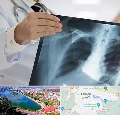 فوق تخصص ریه در لاهیجان