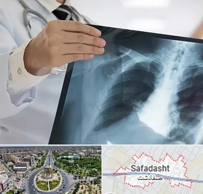 فوق تخصص ریه در صفادشت