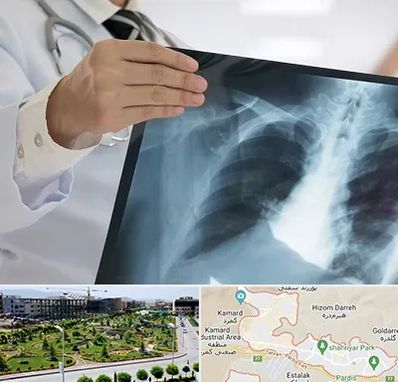 فوق تخصص ریه در پردیس