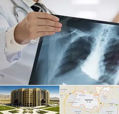 فوق تخصص ریه در نجف آباد