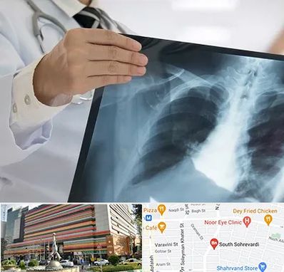 فوق تخصص ریه در سهروردی 