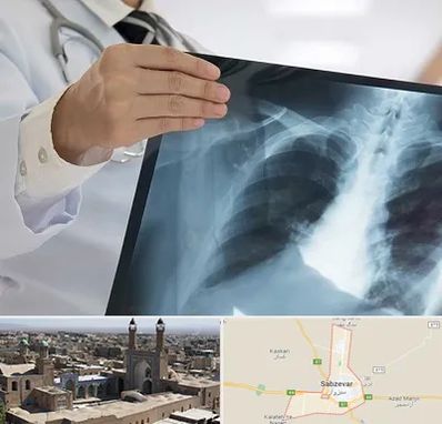 فوق تخصص ریه در سبزوار